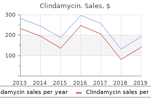 150mg clindamycin