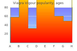order line viagra vigour