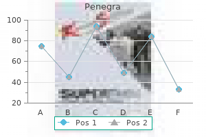 buy cheap penegra 50 mg line