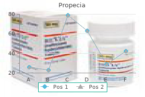 order propecia 5 mg on line