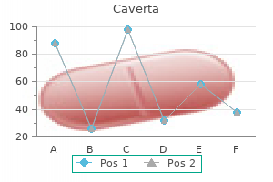 purchase 100 mg caverta with mastercard