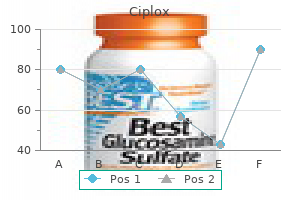 buy generic ciplox 500 mg on line