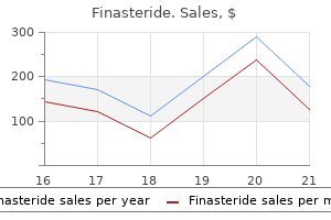 buy finasteride amex