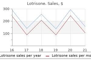 best buy lotrisone