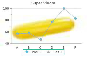 buy super viagra 160 mg mastercard