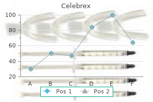 buy celebrex 200mg without a prescription