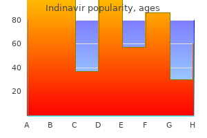 buy indinavir on line amex