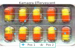 cheap kamagra effervescent 100mg on line