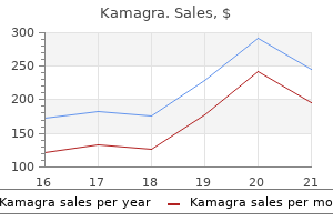 cheap kamagra 100mg on line