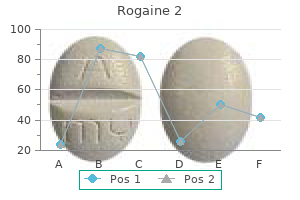 buy cheap rogaine 2 60 ml line