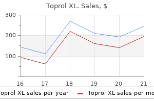 buy toprol xl cheap