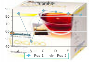 order toprol xl 100 mg overnight delivery